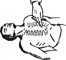 Місце розташування рук під час виконання зовнішнього масажу серця