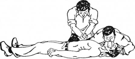Проведення штучного дихання та зовнішнього масажу серця двома особами
