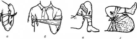 Максимальне згинання кінцівок у суглобах для зупинки кро¬вотечі з: а — передпліччя; б — плеча; в — гомілки; г — стегна