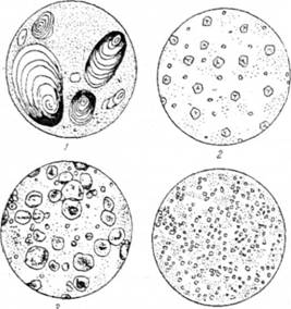 Зерна крохмалю різних видів під мікроскопом (1 — картопляного, 2 — пшеничного, 3 — кукурудзяного, 4 — рисового)
